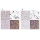 Anti-PYCARD Antibody