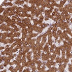 Anti-DISP3 Antibody