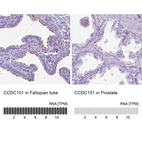 Anti-CCDC151 Antibody