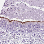 Anti-CCDC151 Antibody