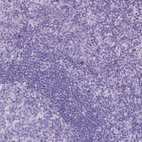 Anti-CCDC151 Antibody