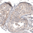 Anti-TNFRSF8 Antibody