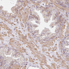 Anti-SULF1 Antibody