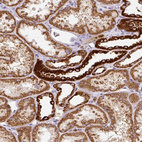 Immunohistochemical staining of human kidney shows moderate to strong granular cytoplasmic positivity in cells in tubules.