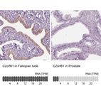 Anti-C2orf81 Antibody