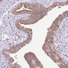 Immunohistochemical staining of human fallopian tube shows moderate cytoplasmic positivity in glandular cells.