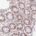 Immunohistochemical staining of human colon shows moderate cytoplasmic positivity in glandular cells.