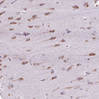 Immunohistochemical staining of human cerebral cortex shows moderate cytoplasmic positivity in neurons.