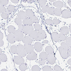 Anti-FASLG Antibody