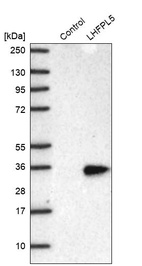 Anti-LHFPL5 Antibody