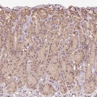 Anti-TMEM170B Antibody