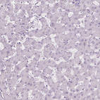 Immunohistochemical staining of human liver shows no positivity in hepatocytes as expected.