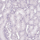 Immunohistochemical staining of human kidney shows no positivity in cells in tubules as expected.