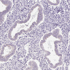 Immunohistochemical staining of human endometrium shows no positivity in glandular cells as expected.