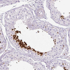 Immunohistochemical staining of human testis shows moderate to strong nuclear positivity in spermatids.