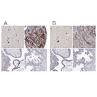 Anti-VGF Antibody