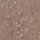 Immunohistochemical staining of human cerebral cortex shows high expression.