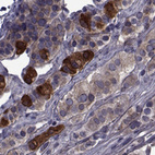 Immunohistochemical staining of human anterior pituitary gland shows strong cytoplasmic positivity in endocrine cells.