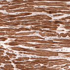 Immunohistochemical staining of human heart muscle shows strong cytoplasmic positivity in cardiomyocytes.