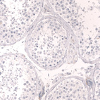 Immunohistochemical staining of human testis shows no positivity in cells in seminiferous ducts as expected.