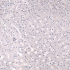 Immunohistochemical staining of human liver shows no positivity in hepatocytes as expected.