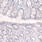 Immunohistochemical staining of human rectum shows no positivity in glandular cells as expected.