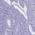 Anti-CR2 Antibody