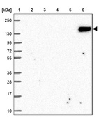 Anti-CR2 Antibody