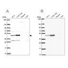 Anti-RRS1 Antibody