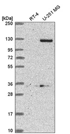 Anti-DSEL Antibody