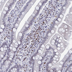 Anti-C15orf41 Antibody