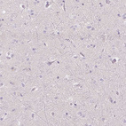 Anti-UPK2 Antibody