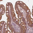 Anti-C14orf79 Antibody