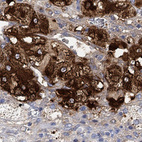 Anti-VAT1L Antibody