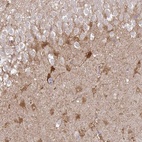 Anti-SHISA4 Antibody