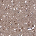 Anti-TARBP2 Antibody