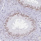 Anti-PBX2 Antibody