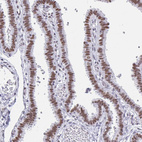 Anti-PBX2 Antibody