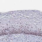 Anti-PBX2 Antibody