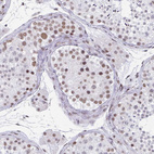 Anti-PBX2 Antibody