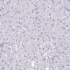 Anti-PBX2 Antibody