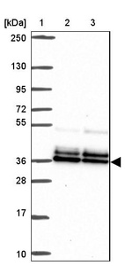 Anti-PBX2 Antibody