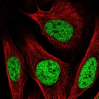 Anti-PBX2 Antibody