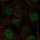 Anti-CCDC63 Antibody