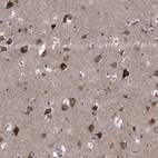 Anti-SLC2A13 Antibody