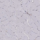 Immunohistochemical staining of human skeletal muscle shows low expression as expected.