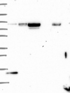 Lane 1: Marker [kDa] 250, 130, 95, 72, 55, 36, 28, 17, 10 | Lane 2: RT4 | Lane 3: U-251 MG | Lane 4: Human Plasma | Lane 5: Liver | Lane 6: Tonsil