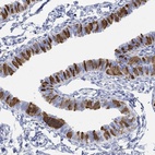 Anti-TPPP3 Antibody