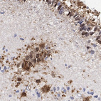 Anti-TPPP3 Antibody