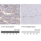 Anti-F11R Antibody